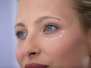 Close-up of woman with marks drawn for cosmetic treatment